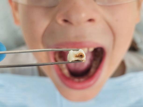 Best Emergency Care for Gum Disease in Lake City, FL